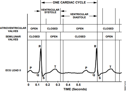 Typical ECG Waveform