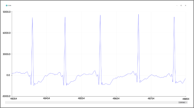 Figure 14. Example output from the MAX30003WING_Demo_QRS program.