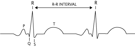 Figure 1. A typical ECG waveform representing the heart