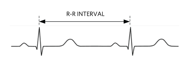 Figure 2. R-R interval in a typical ECG waveform.