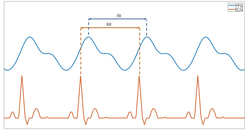 Figure 1. ECG and PPG waveforms with IBIs illustrated.