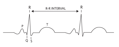 Figure 2. R-R interval in a typical ECG waveform.