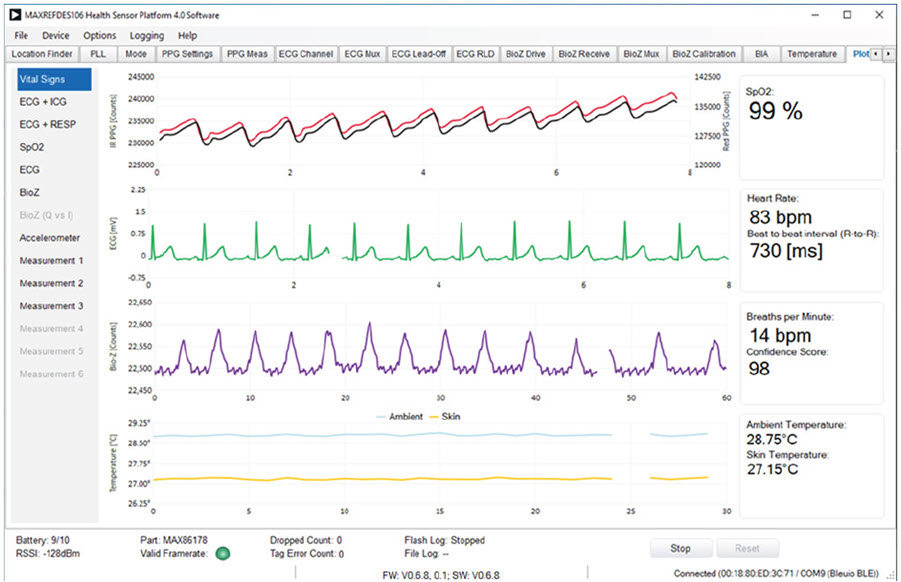 GUI Vital Signs Plots Summary