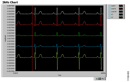 Screen Capture of ADAS1000 with Patient Simulator Connected, Heart Rate = 70 BPM