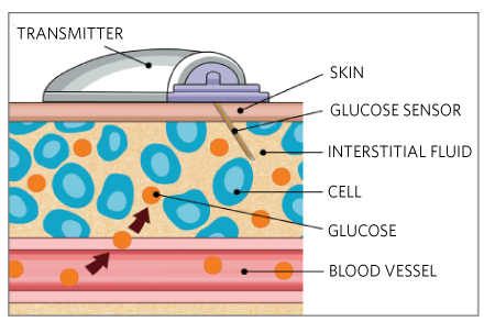 Figure 4. Cross-section illustration of a CGM contacting with skin.