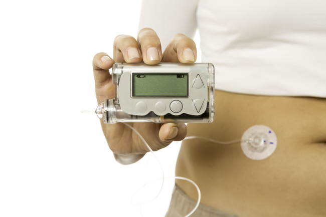 Figure 5. Insulin pump.