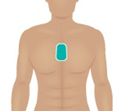 Figure 1. Patient wearing a medical patch.