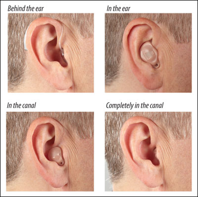 耳の後ろに装着する型式(BTE)、耳内に装着する型式(ITE)、外耳道入口に装着する型式(ITC)、および外耳道内部に隠す型式(CIC) (写真提供：Starkey Laboratories, Inc.)