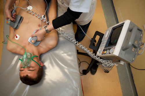 A hospital-style defibrillator with paddles. Note that there is an external electrocardiograph (ECG) or heart monitor on the patient, as evidenced by the white circles (electrodes) and leads (wires) on the chest.