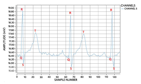 ECG waveform using 128x gain.