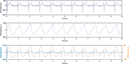 Simultaneous ECG and PPG measurement for blood pressure estimation